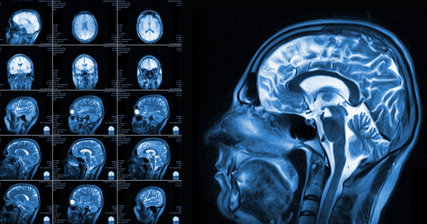 Une simulation saisissante montre ce qui arrive à notre cerveau dans les 10 minutes suivant la mort