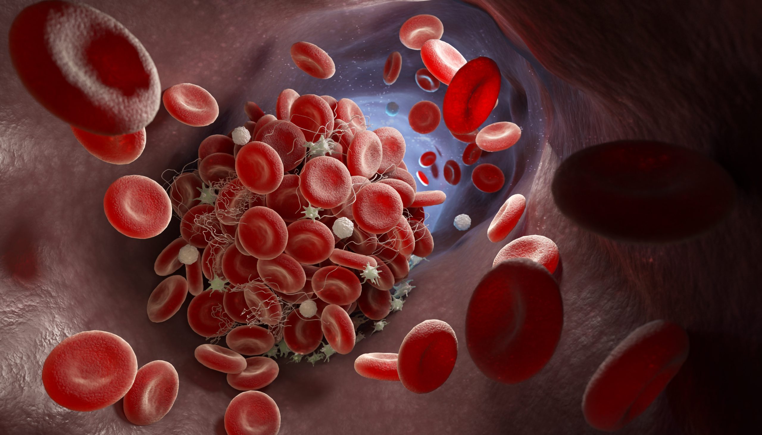 Comment prévenir la thrombose ?