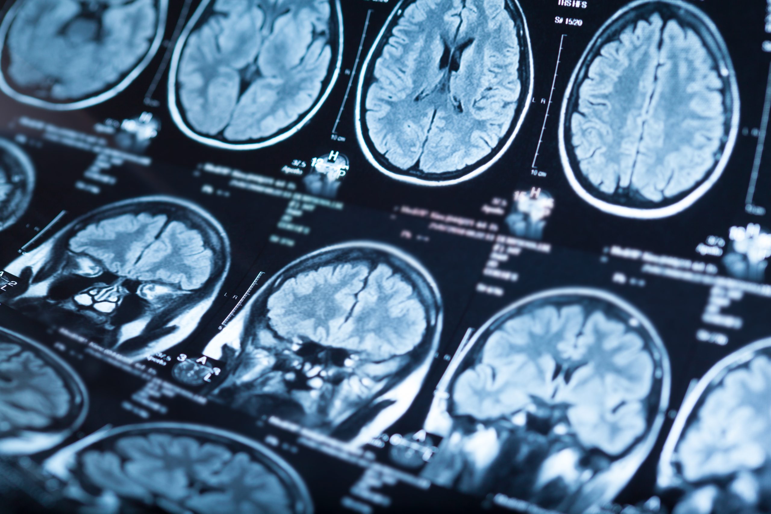 Conclusion : la vraie puissance du cerveau, c’est sa diversité
