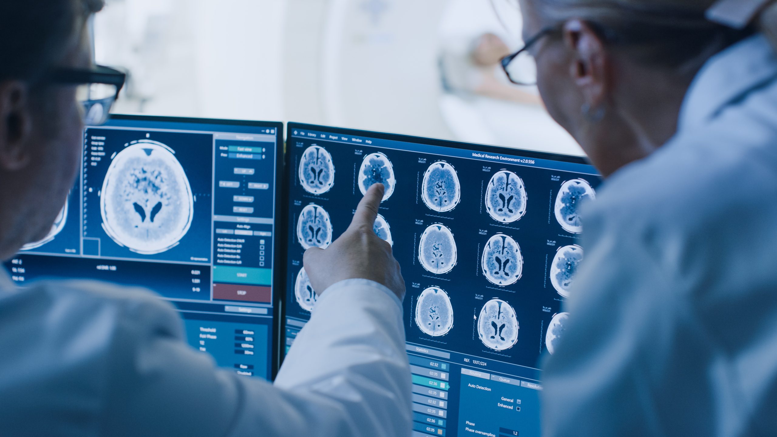 La taille du cerveau : un chiffre qui ne dit pas tout