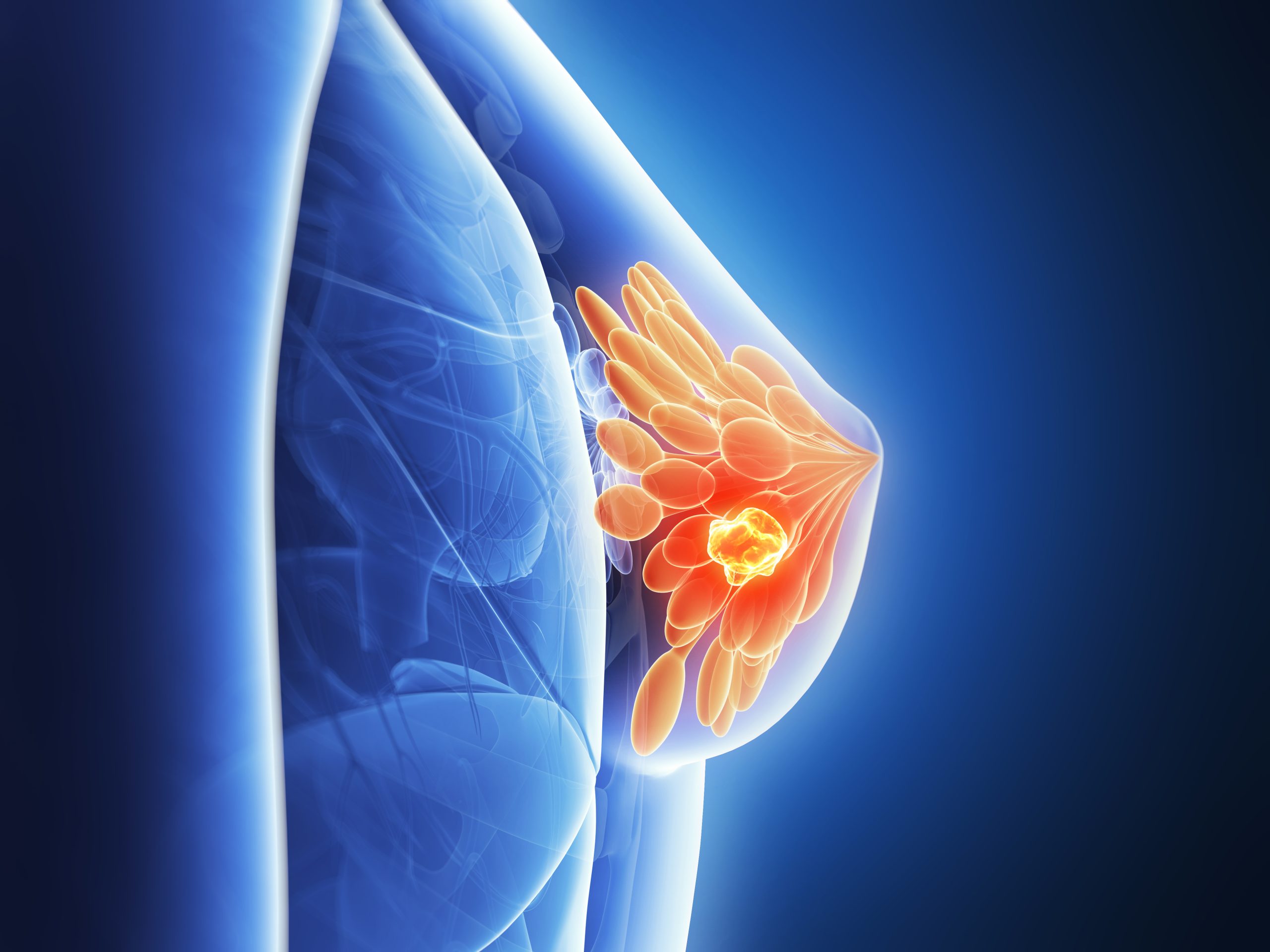 Une innovation majeure dans la lutte contre le cancer