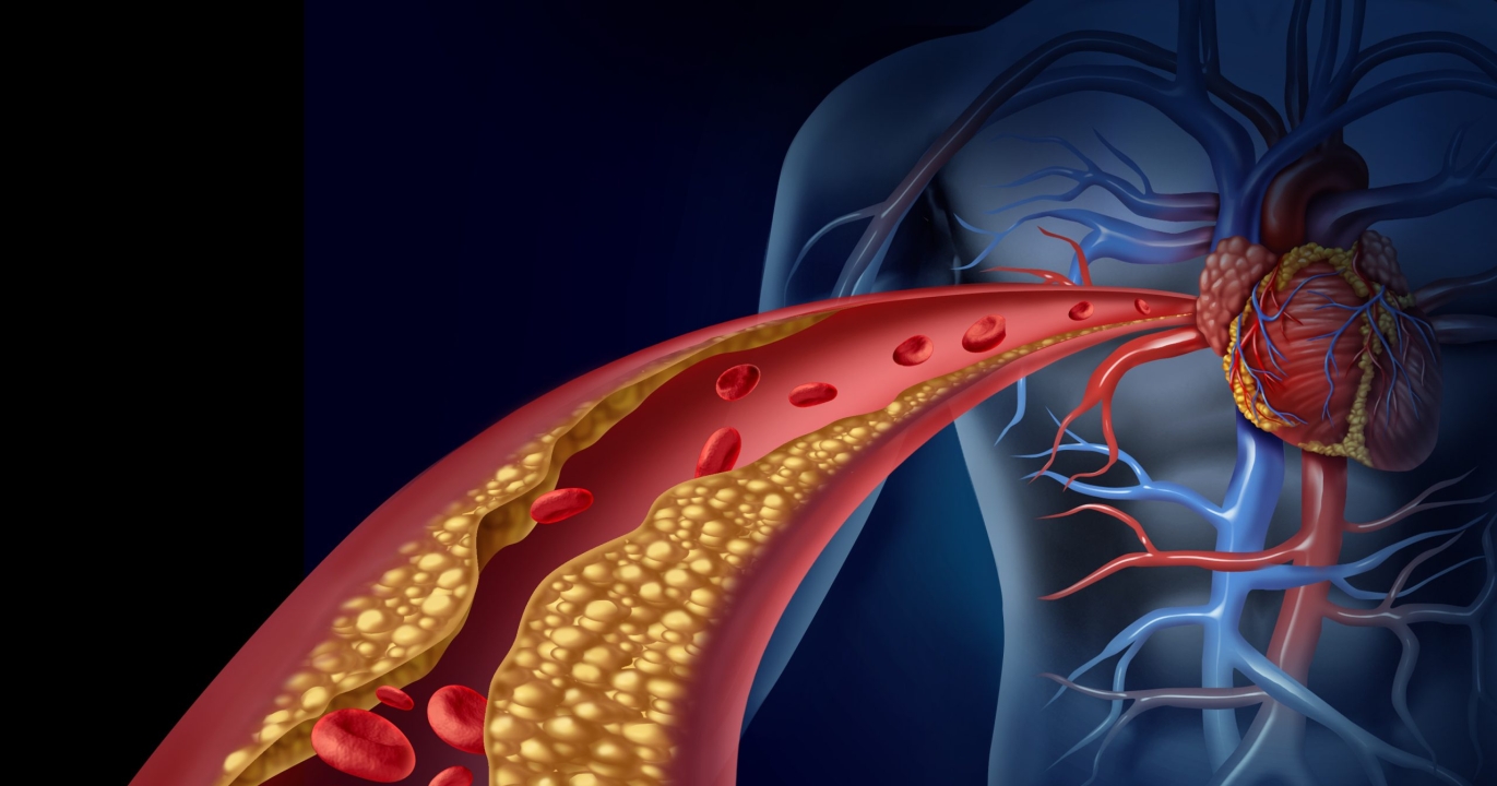 La machine révolutionnaire de Dahir Insaat promet de nettoyer les artères sans chirurgie invasive
