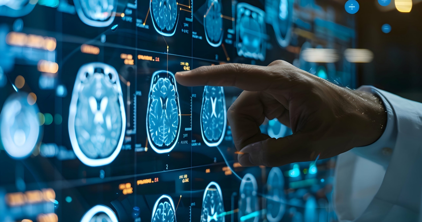 Les scientifiques ont enfin identifié la bactérie qui déclenche la sclérose en plaques